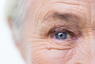 Diabetic Eye Disease